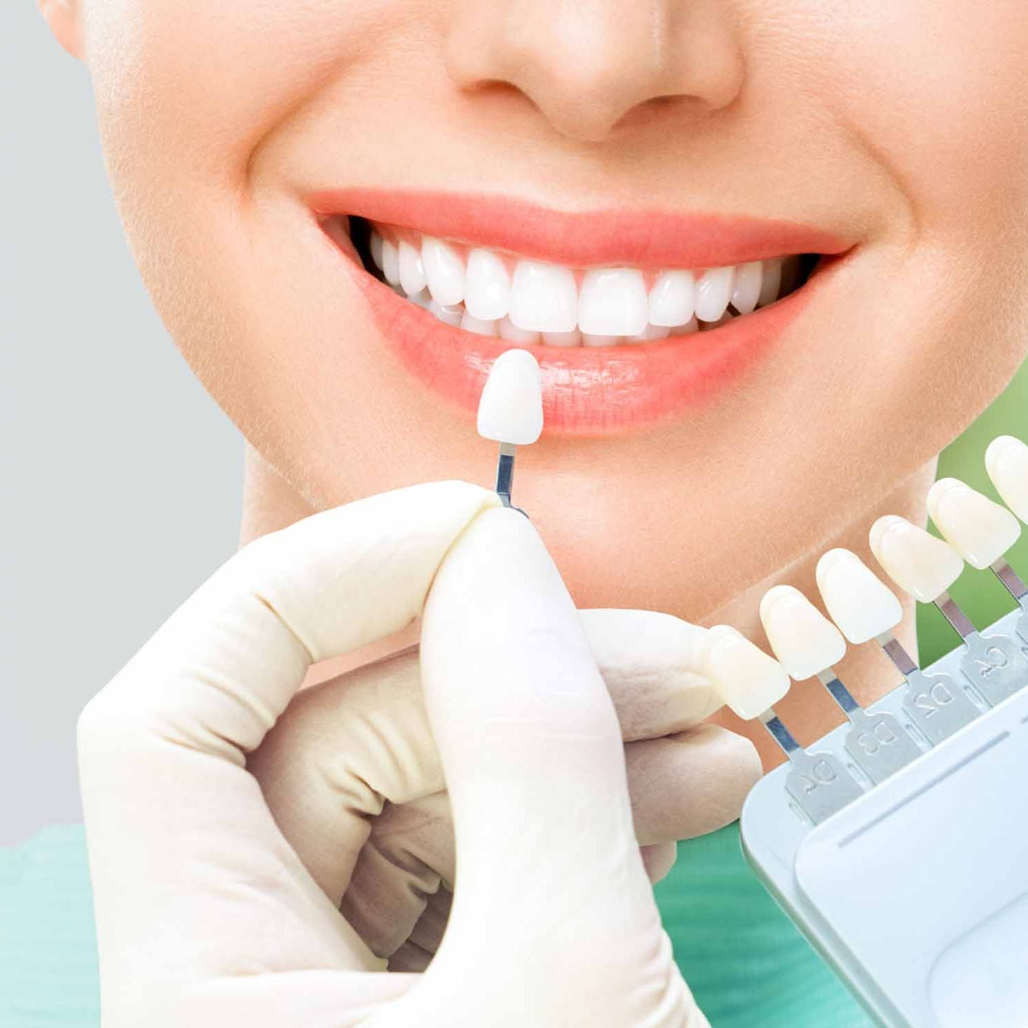 Teeth whitening, what a brilliant smile